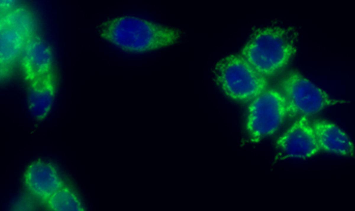 Microscope image of cancer cells coloured green and blue against black
