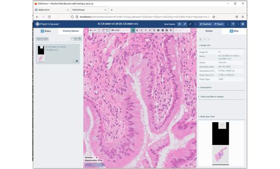Screengrab of iCAIRD showing pink scan of biological tissue