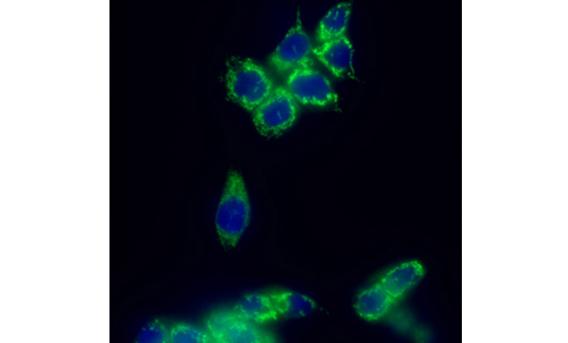 Microscopy image of cancer cells, showing green against a black background.